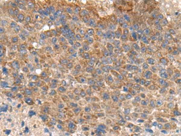 MIA / CD-RAP Antibody