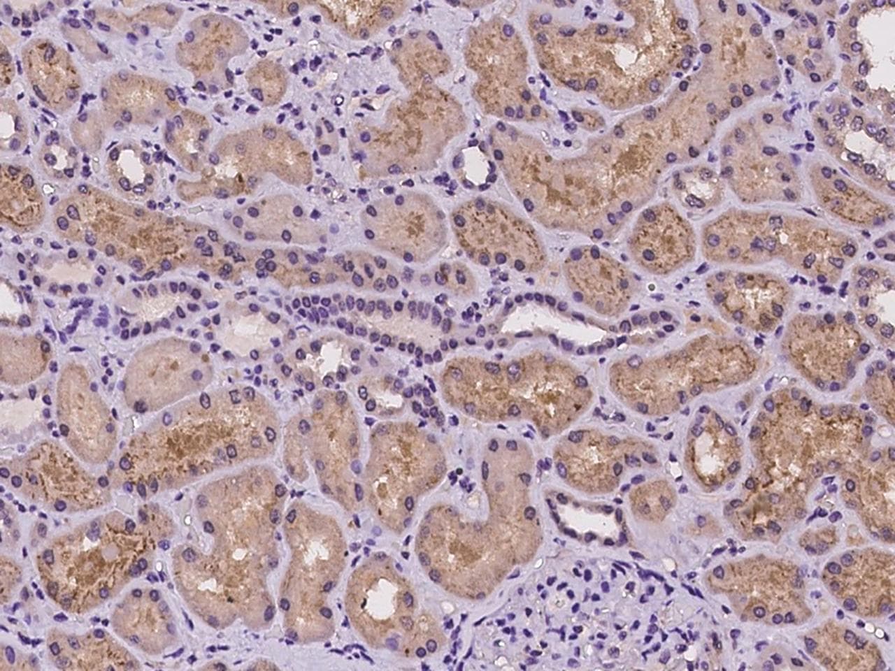 GNL1 Antibody