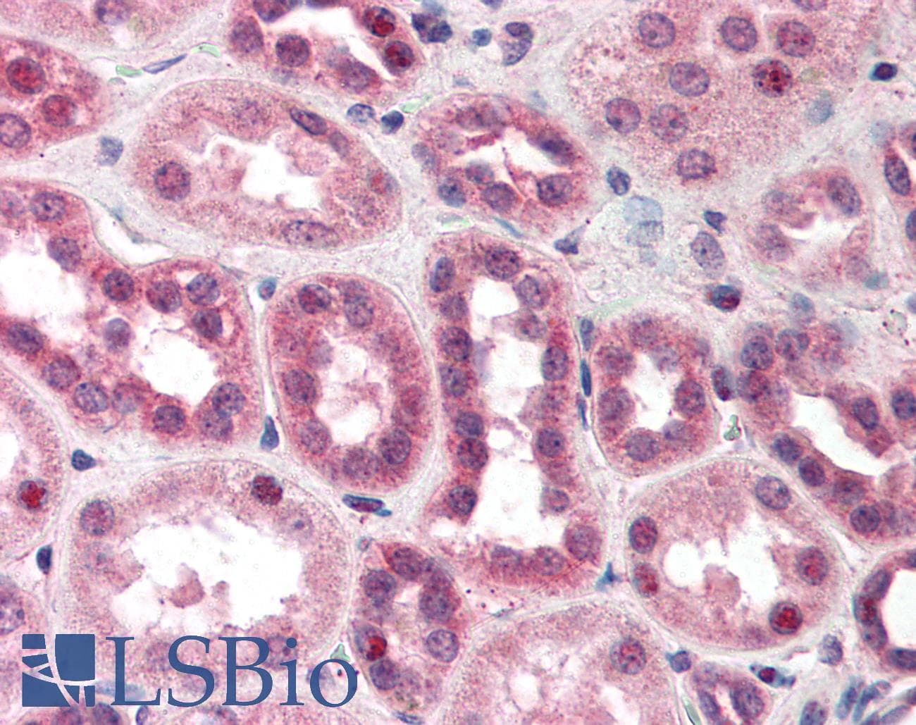 IHC-plus™ Polyclonal Rabbit anti-Human CUL5 / Cullin-5 Antibody (aa1-25, IHC, WB)