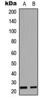Polyclonal Rabbit anti-Human EDN1 / Endothelin 1 Antibody (Internal, WB)