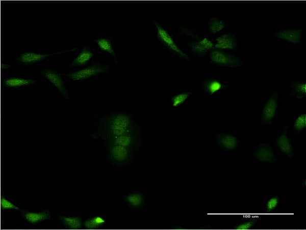 IHC-plus™ CSNK1E / CK1 Epsilon Antibody (clone 2E1)