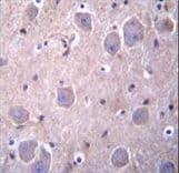 RAP1GDS1 / SmgGDS Antibody (aa217-244)