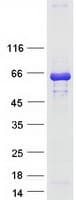 Human LAD1 Protein (Recombinant Myc-DDK (Flag))