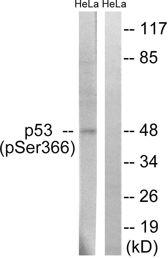 Polyclonal Rabbit anti-Human TP53 / p53 Antibody (phospho-Ser366, IHC, WB)
