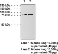 IHC-plus™ Polyclonal Rabbit anti-Human GUCY1A1 / GUCY1A3 Antibody (IHC, WB)