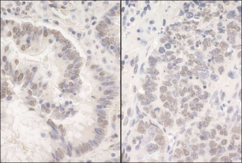PUF60 Antibody (aa400-450)