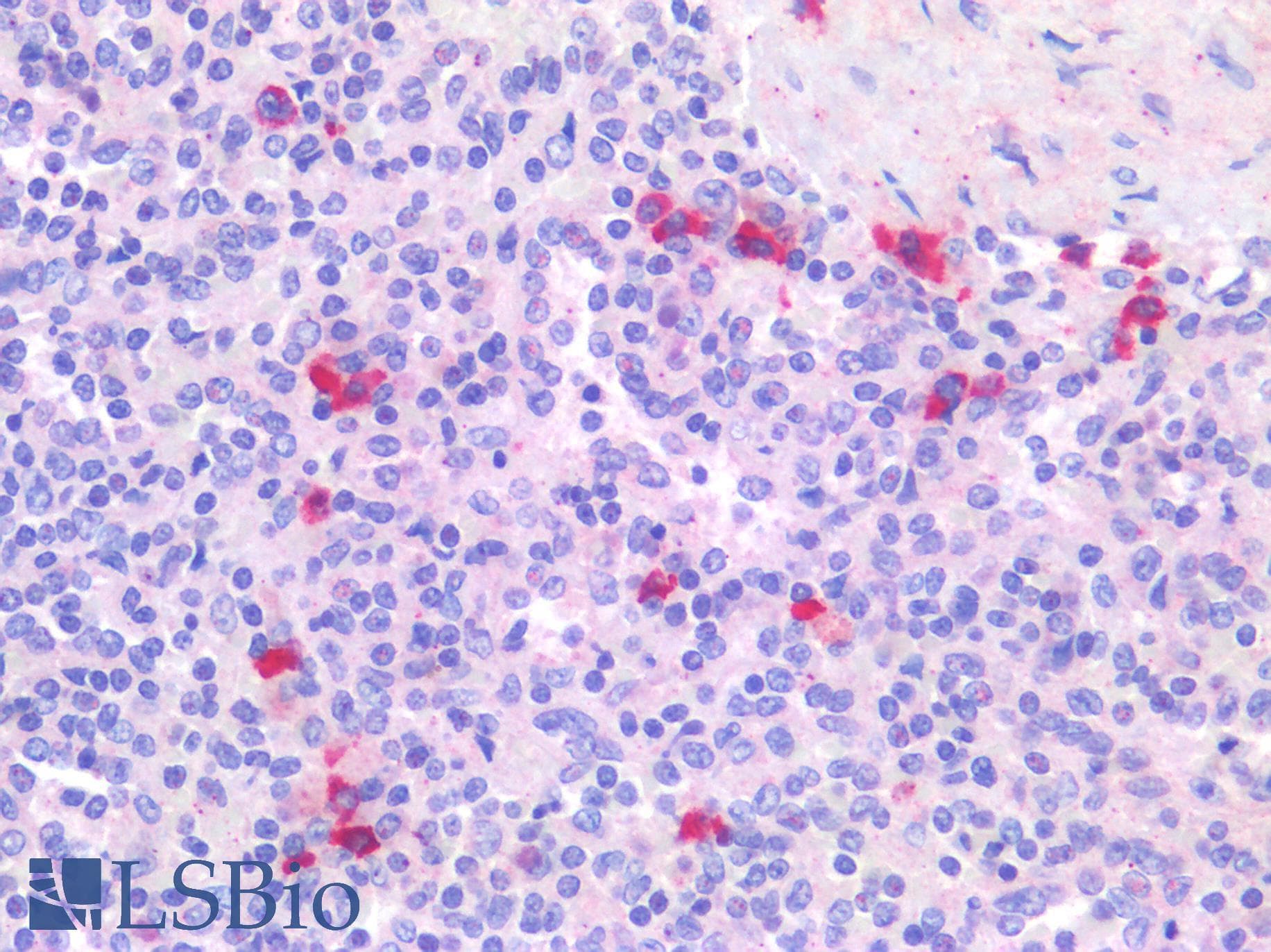 PathPlus™ Polyclonal Rabbit anti-Human BTLA / CD272 Antibody (IHC)