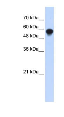 Polyclonal Rabbit anti-Human IRF6 Antibody (C-Terminus, WB)
