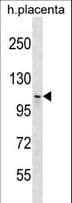 MMS19 Antibody (aa411-437)