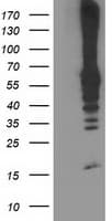 RPN1 / Ribophorin I Antibody (clone OTI5A1)