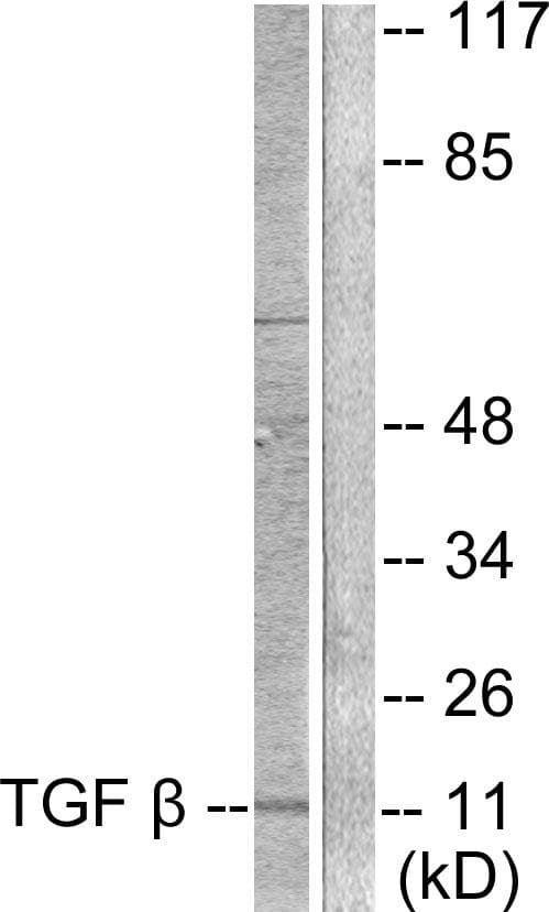 TGFB3 / TGF Beta3 Antibody