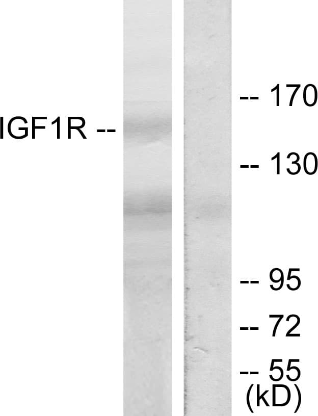 IGF1R / IGF1 Receptor Antibody (aa1131-1180)