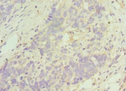 TACR3 / NK3R Antibody (aa356-465)