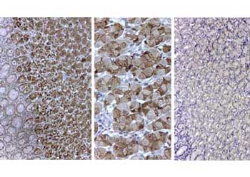 Pepsin Antibody (Liquid)