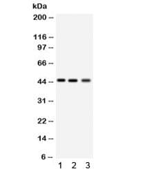 AGER / RAGE Antibody