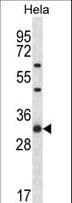 RPL7 / Ribosomal Protein L7 Antibody (aa6-35)