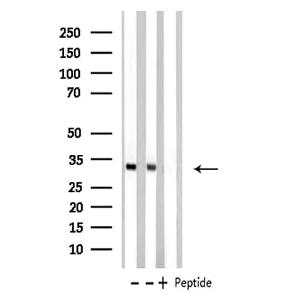 Polyclonal Rabbit anti-Human MED8 Antibody (IF, WB)