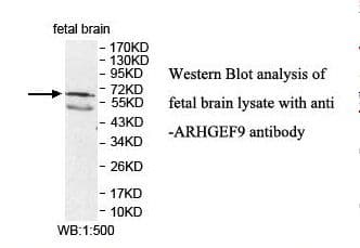 Polyclonal Rabbit anti-Human ARHGEF9 / Collybistin Antibody (aa66-255, IHC, WB)