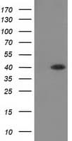 HAO1 Antibody (clone OTI5C3)