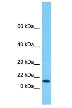 Polyclonal Rabbit anti-Human VHLL Antibody (aa2-51, WB)
