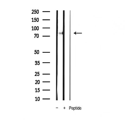 Polyclonal Rabbit anti-Human STAT4 Antibody (phospho-Tyr693, IHC, IF, WB)