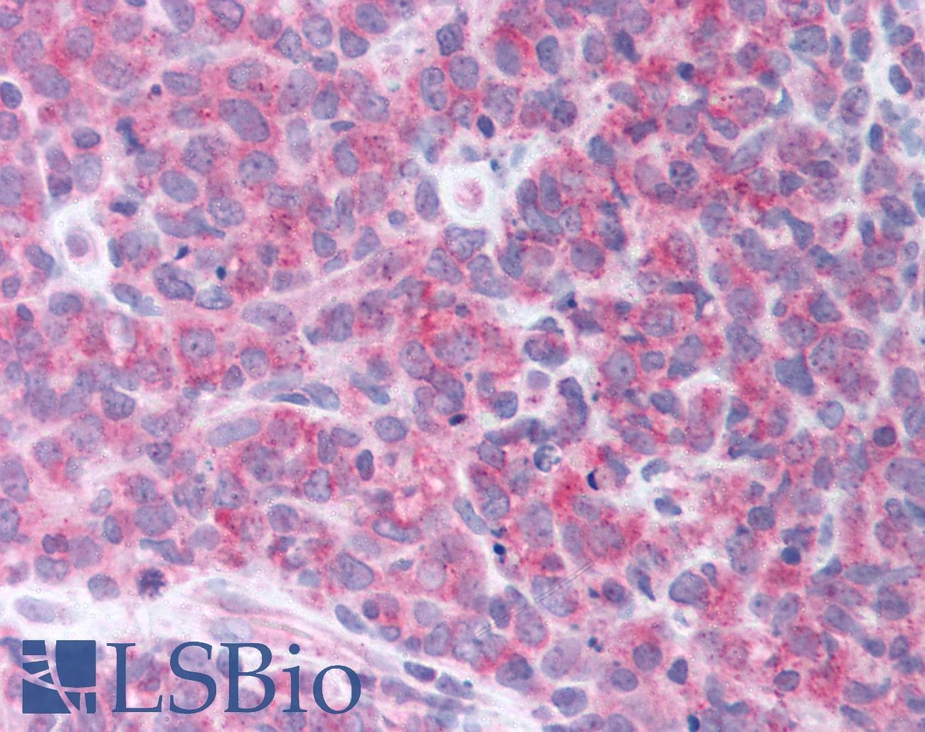 IHC-plus™ KATII / AADAT Antibody (Internal)