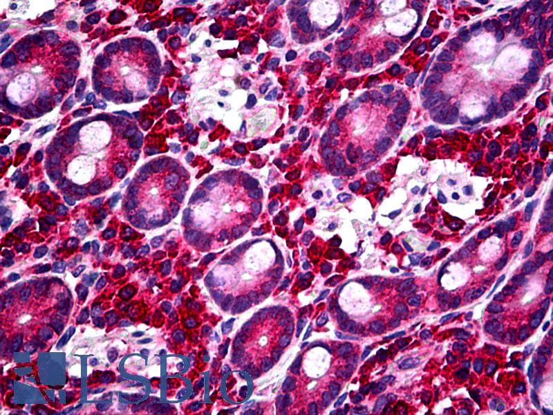 IHC-plus™ Polyclonal Rabbit anti-Human PIK3CB / PI3K Beta Antibody (Internal, IHC, WB)