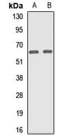 Polyclonal Rabbit anti-Human VPS33B Antibody (WB)