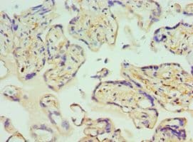 GLRX2 / Glutaredoxin 2 Antibody (aa1-124)
