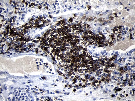 CD79B / CD79 Beta Antibody (clone OTI8A12)
