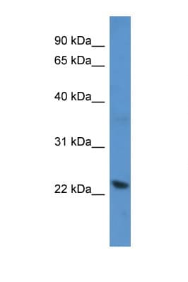Polyclonal Rabbit anti-Human Recoverin Antibody (C-Terminus, WB)