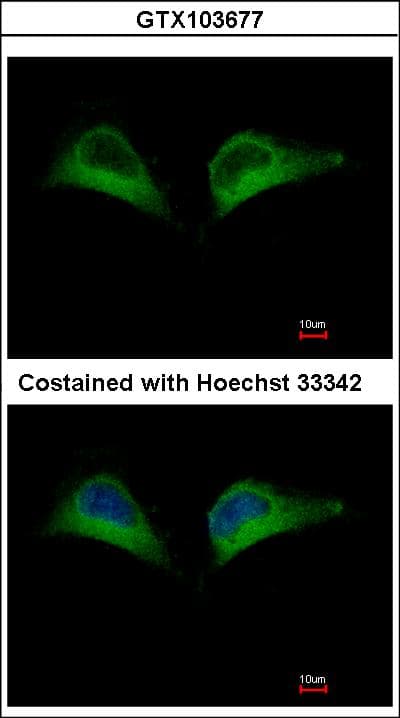 PSMD7 / MOV34 Antibody