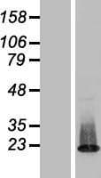 ZNF385C Protein (Over-Expression Lysate Myc-DDK (Flag))