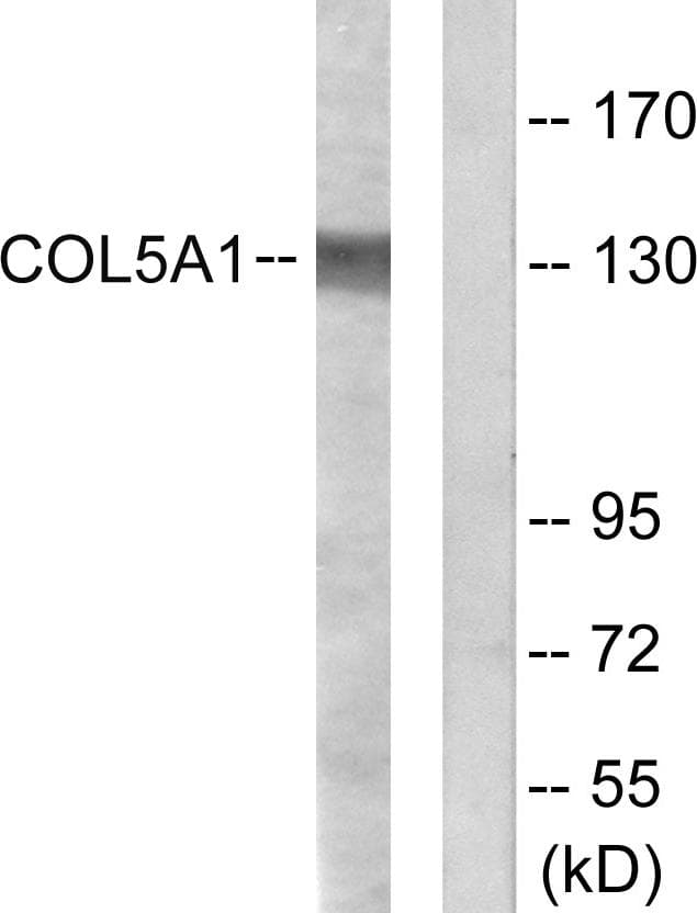 Polyclonal Rabbit anti-Human COL5A1 / Collagen V Alpha 1 Antibody (IHC, IF, WB)