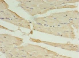 CA-VB / CA5B Antibody (FITC)