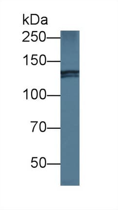 NIN / Ninein Antibody (aa1-153, APC)