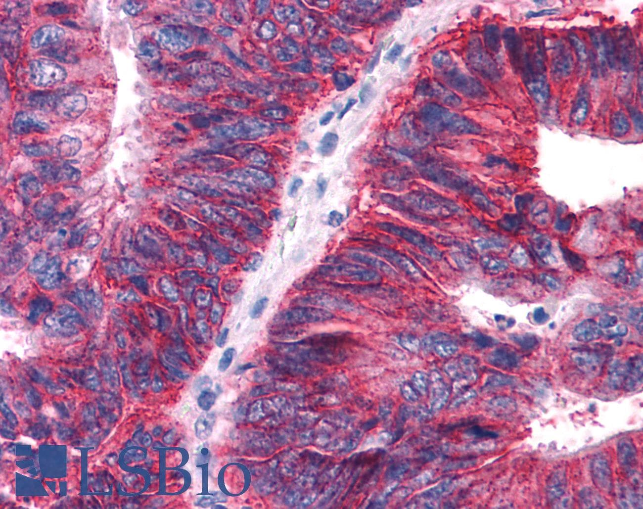 PathPlus™ Polyclonal Rabbit anti-Human APLNR/ Apelin Receptor / APJ Antibody (Extracellular Domain, IHC)
