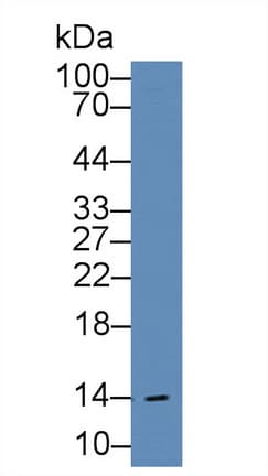 FABP1 / L-FABP Antibody (aa1-127, APC)