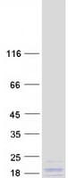 Human UQCRH Protein (Recombinant Myc-DDK (Flag))