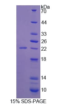 Human CNTN2 / TAX Protein (Recombinant His)
