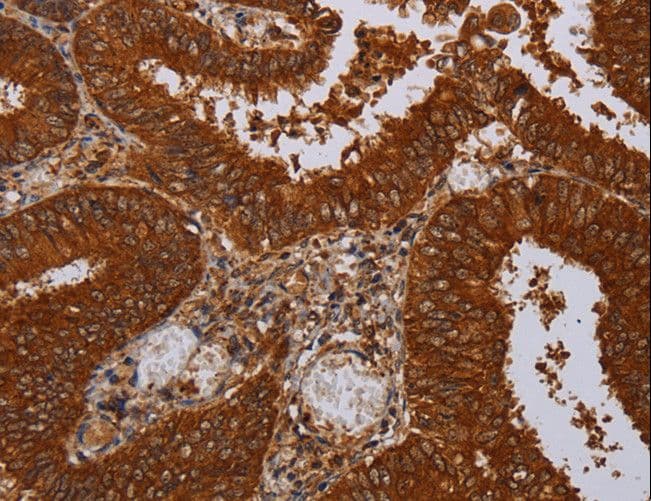 MFAP3L / NYD-Sp9 Antibody