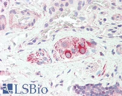 IHC-plus™ NRTN / Neurturin Antibody (aa178-193)