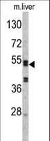 Polyclonal Rabbit anti-Human Antithrombin-III Antibody (aa364-393, IHC, IF, WB)