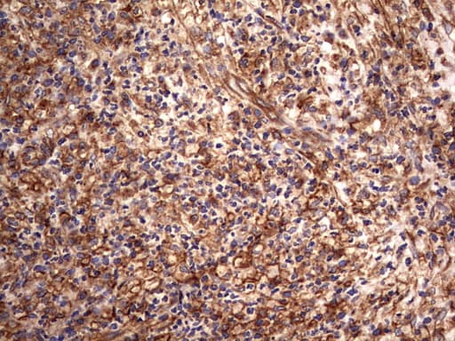 KRT7 / CK7 / Cytokeratin 7 Antibody (clone OTI2A2)