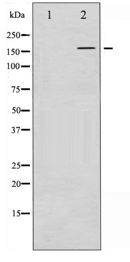 FANCD2 Antibody (phospho-Ser222)