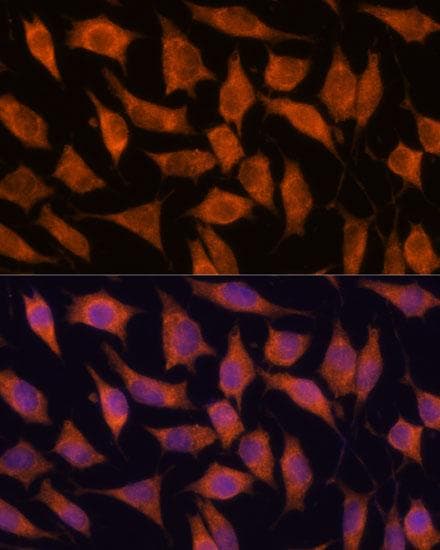 KIF13A Antibody
