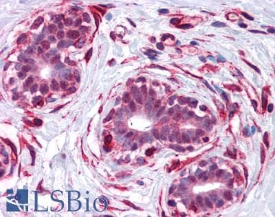 IHC-plus™ Polyclonal Rabbit anti-Human KDM3B / JMJD1B Antibody (IHC, IF, WB)