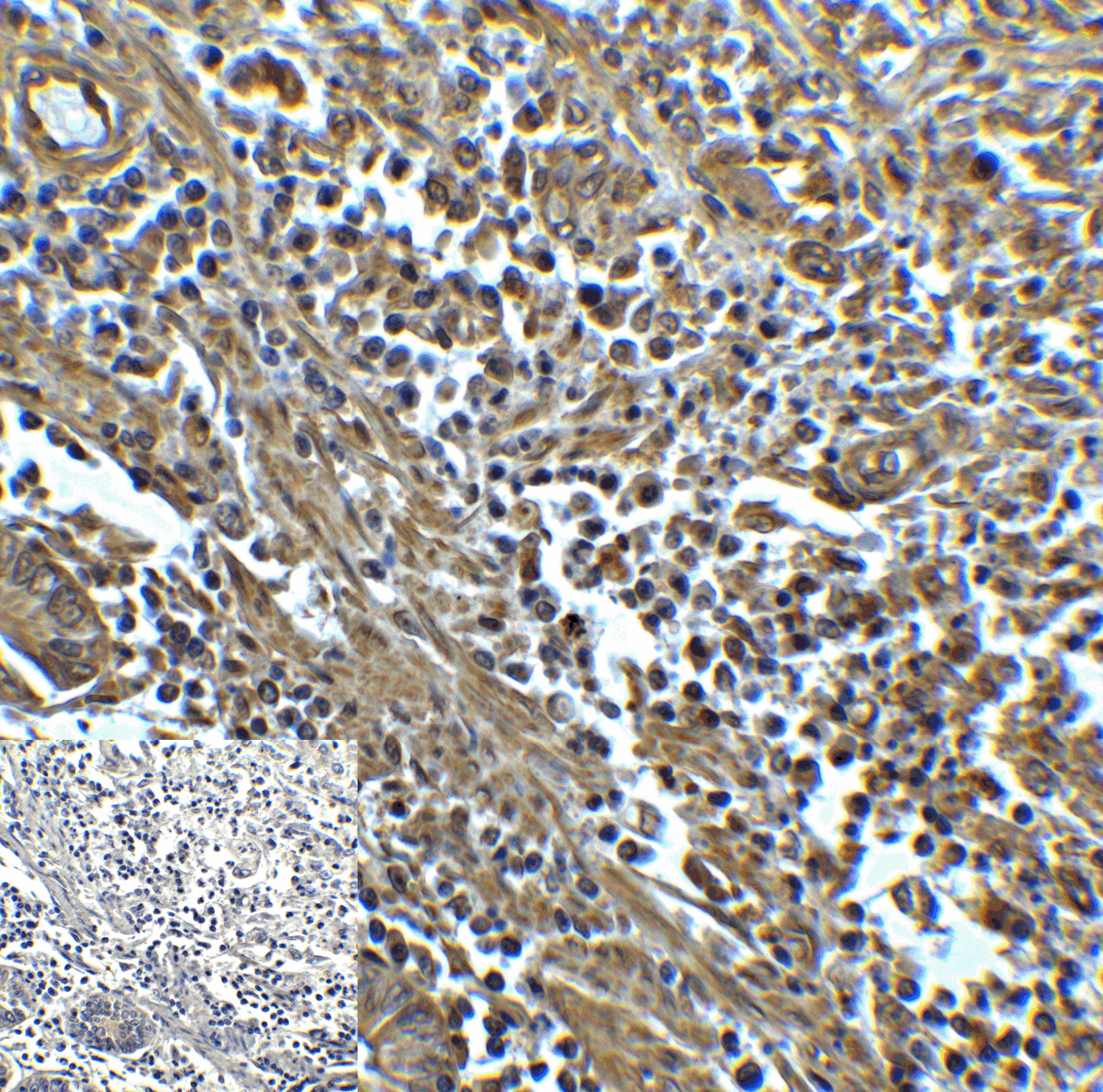 HAVCR2 / TIM-3 Antibody (clone 9G1)