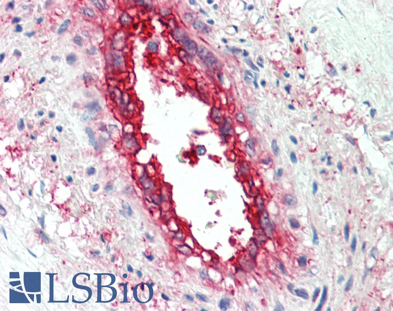 IHC-plus™ EHD2 Antibody (aa529-542)