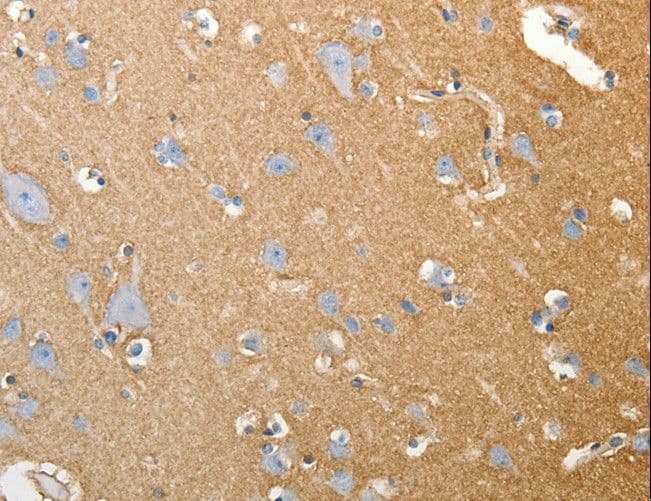 Polyclonal Rabbit anti-Human SLC4A4 / NBC1 Antibody (IHC)